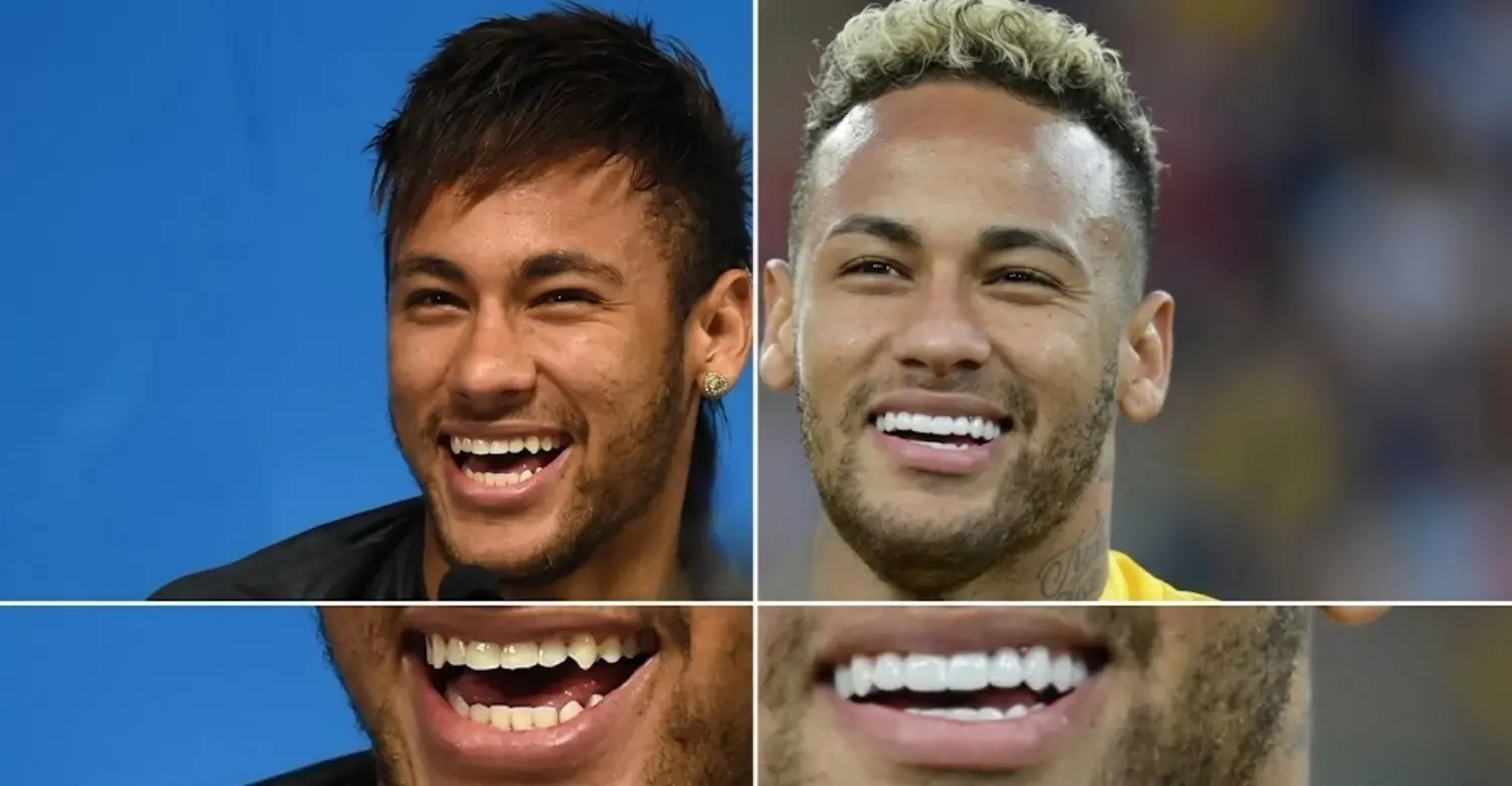 Neymar teeth